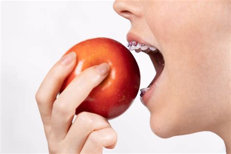What to Do if Food Gets Stuck While Eating with Braces - Exeter Smiles