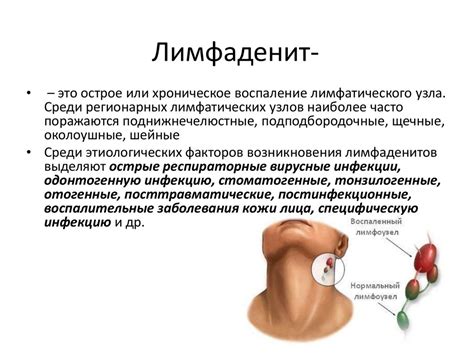 Лимфадениты челюстнолицевой области. Классификация. Клинические ...