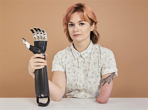 prosthetic arms