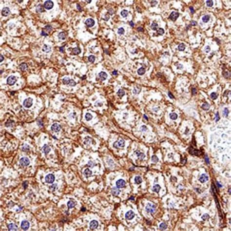 abca antibody aantibodiesprimary antibodies fisher
