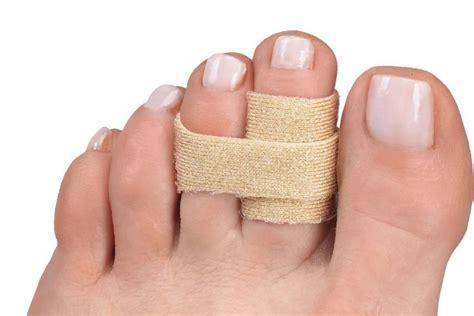 toe fracture treatment protective footwear orthotics  melbourne