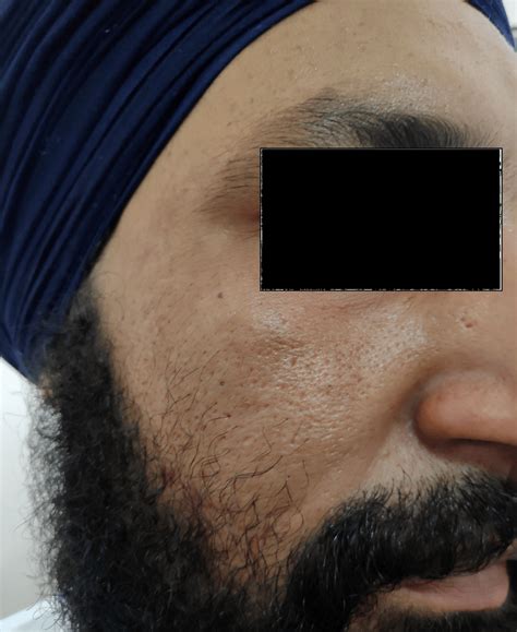 side  face   weeks  scientific diagram