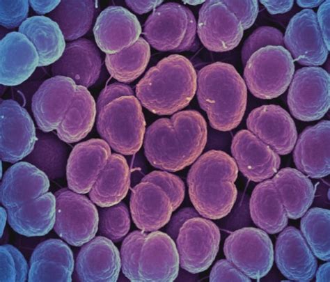 Difference Between Fastidious and Nonfastidious Bacteria | Compare the ...