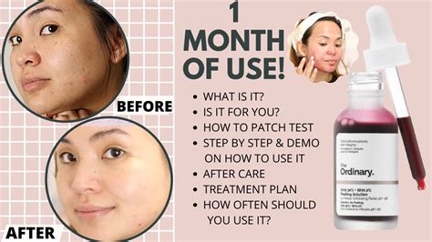 ordinary aha  bha  peeling solution