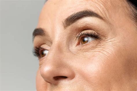 wrinkles  eyes   area ages differently