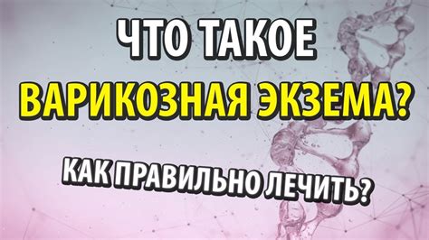 Что такое варикозная экзема. Как лечить - YouTube