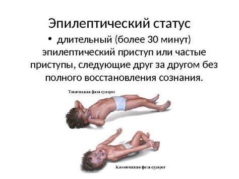 Этиология, патогенез, классификация и клиника эпилепсии