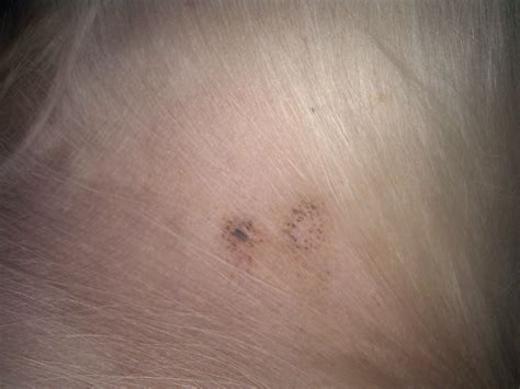 spots on dog's belly