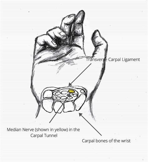 Common Conditions | Carpal Tunnel Sydrome | Specialised Hand Therapy