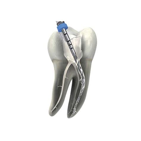 Обзор эндодонтических файлов Mtwo