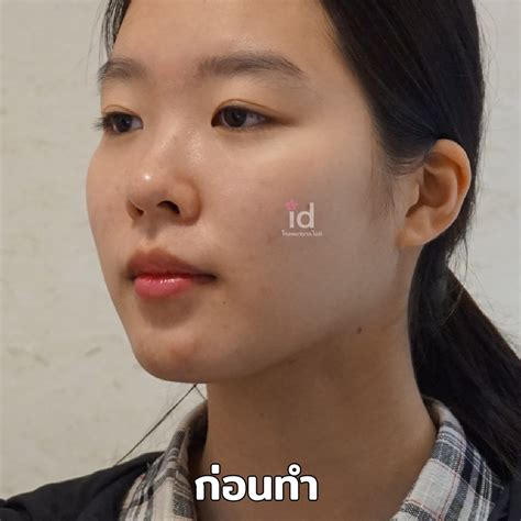Adjust cheekbones/jaw/chin - STM Style