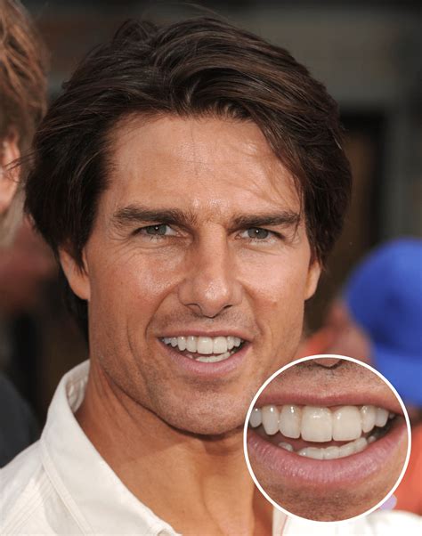 Tom Cruise's Smile: Is His Perfect Middle Tooth All Natural? A Deep Dive. Image 8