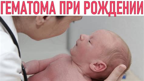 ГЕМАТОМА НА ГОЛОВЕ У НОВВОРОЖДЕННОГО | Опасна ли кефалогематома - YouTube