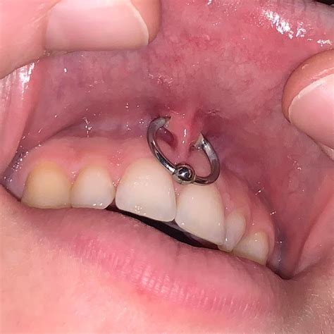 how to clean smiley piercing