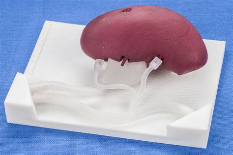 3D Printed Kidney Is A Better And Cheaper Training Tool