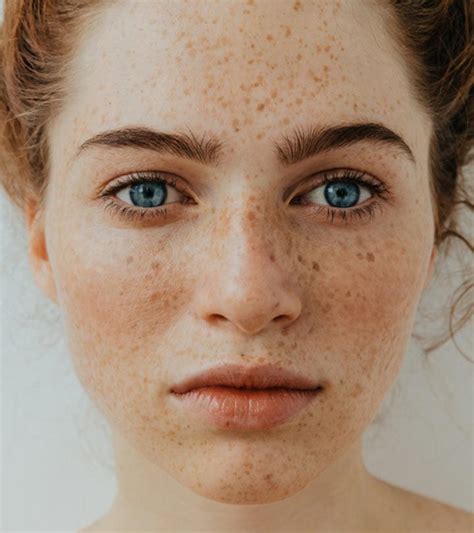 rid  freckles  face  makeup saubhaya makeup