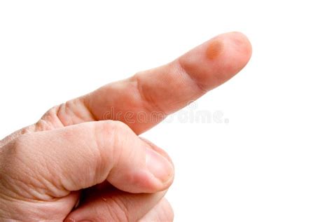 Blaar stock afbeelding. Image of blaar, klinisch, geneeskunde - 7778083