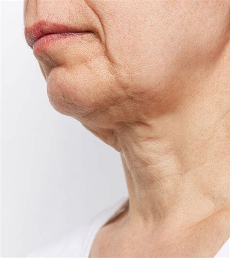 PLASTIC SURGERY - Neck Lift - Everlastwellness