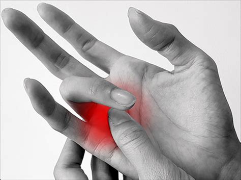 Understanding Tenosynovitis: Causes, Symptoms, and Treatments