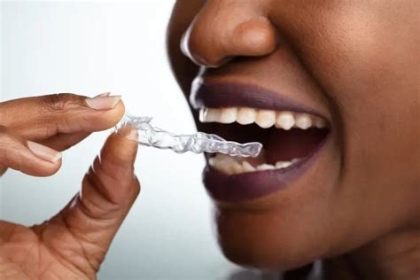 Byte vs. Invisalign: Which Aligner Option Is Right for You? | Byte®