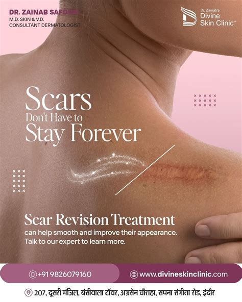 blackheads  face ad design  scar removal clinic scar treatment