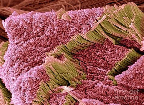 tendon   science photo library