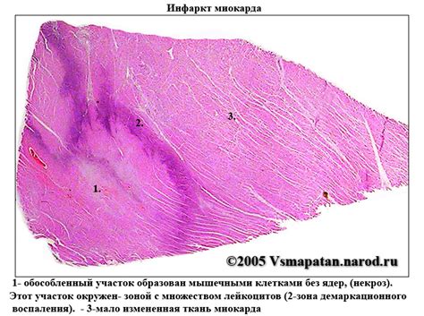 микропрепараты