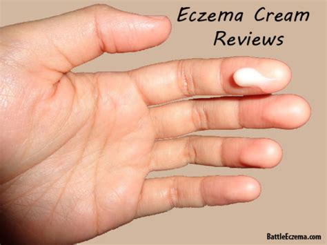 Eczema Cream Reviews - Battle Eczema