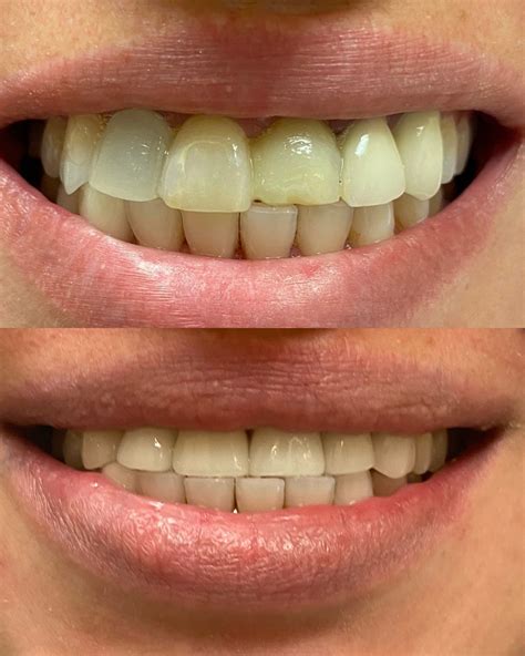 TK Dental Wayne | Dentists Wayne, NJ | Dr. Tatyana Kaminar, DDS