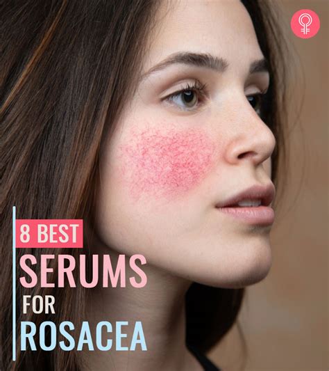 mineral makeup brand  rosacea saubhaya makeup