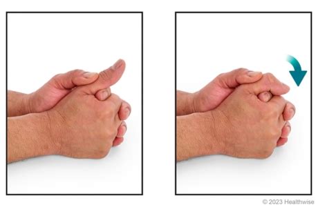 Thumb Sprain: Rehab Exercises | Kaiser Permanente