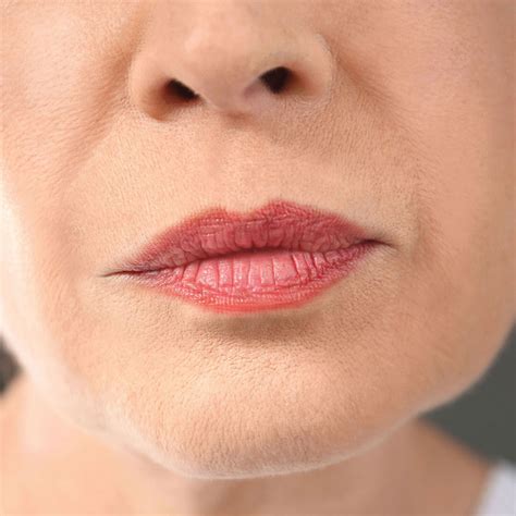 marionette lines everlastwellness