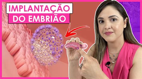Implantação Do Embrião No Útero - SINTOMAS DA IMPLANTAÇÃO DO EMBRIÃO NO ÚTERO - YouTube