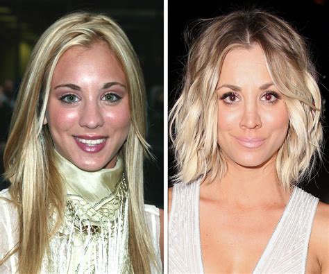 Kaley Cuoco: Plastic surgery best thing I’ve ever done