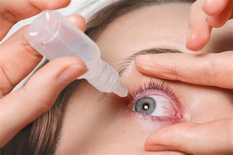 Como Desinchar O Olho De Alergia - Como identificar uma alergia nos olhos? - Clinica Croce
