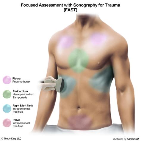 👑 AnKing Step Deck Update #4 : r/medicalschoolanki