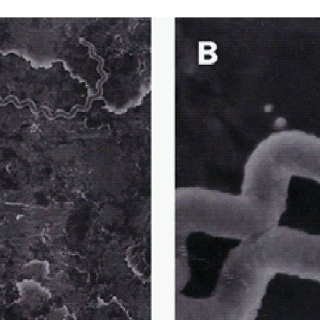 (PDF) LEPTOSPIRA: Morphology, Classification and Pathogenesis