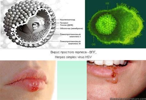 Клиническая фармакология противовирусных лекарственных средств ...