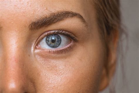 Herpes Simplex Eye Infections - Symptoms & Treatment from Healthily
