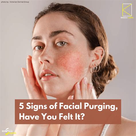signs  facial purging   felt