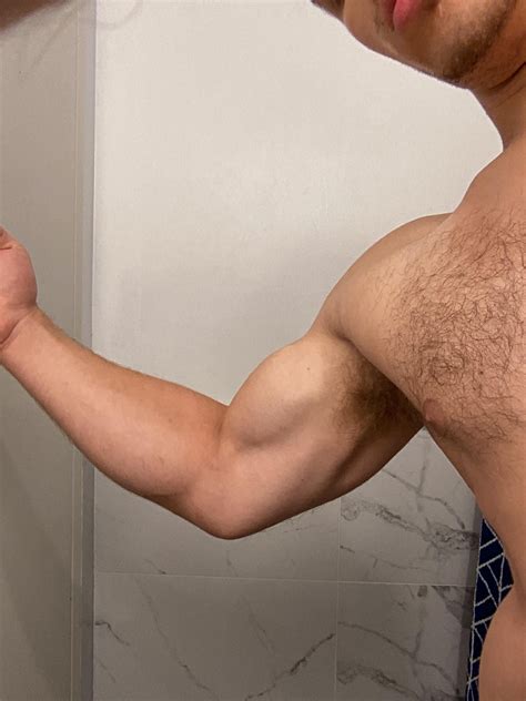 Lump on left bicep after doing pull-ups? : r/InjuriesAndWounds