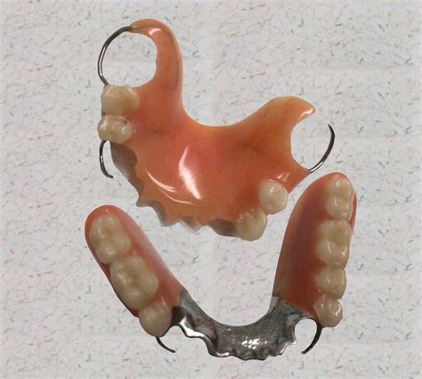 partial castacrylic dentures flippers custom options grantham