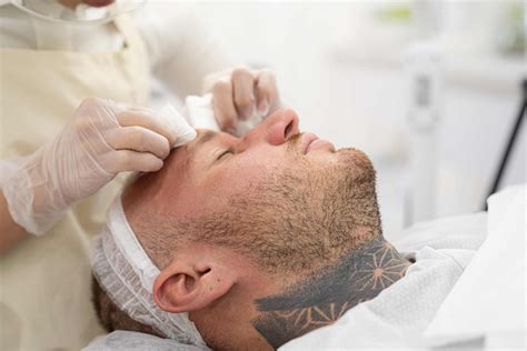 Sun Damage and Men’s Skin: Repair It with These Facials