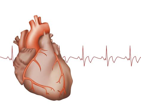 What are the risks of WPW (Wolff-Parkinson-White) syndrome
