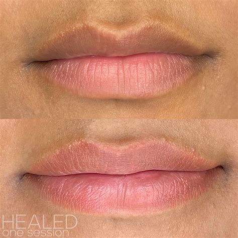 Why Is My Top Lip Darker Than My Bottom Lip - Infoupdate.org