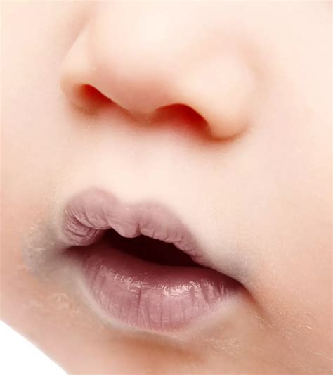 Circumoral Cyanosis In Newborns: Symptoms And Treatment