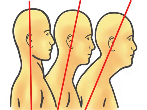 eliminate  head prehab exercises