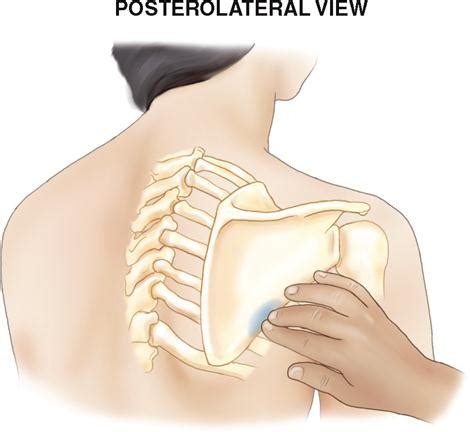 5. Bony Palpation | Musculoskeletal Key