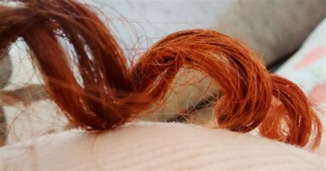 Bedbugs in Hair: Can They Live Anywhere on Your Body?