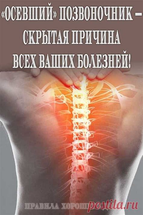 «Осевший» позвоночник — скрытая причина всех ваших болезней! - Полезн ...
